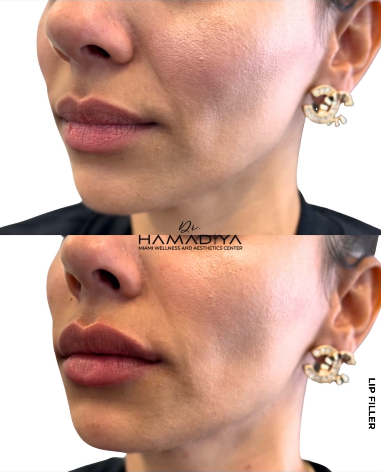 Post 10 by ShaKer Hamadiya, MD on TikTok (video)