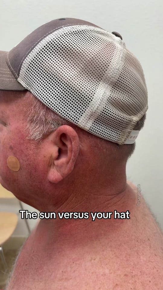 Post 7 by DR GEE | Dermatologist on TikTok (video)
