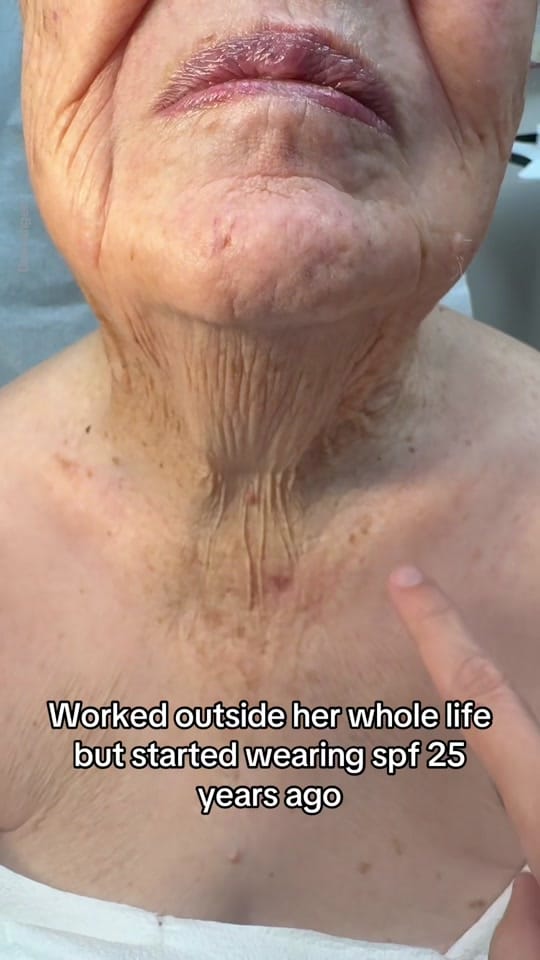 Post 5 by DR GEE | Dermatologist on TikTok (video)
