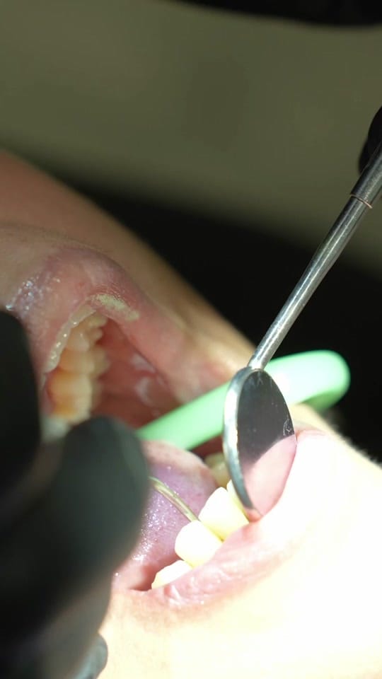 Post 2 by Brickell Dental on TikTok (video)
