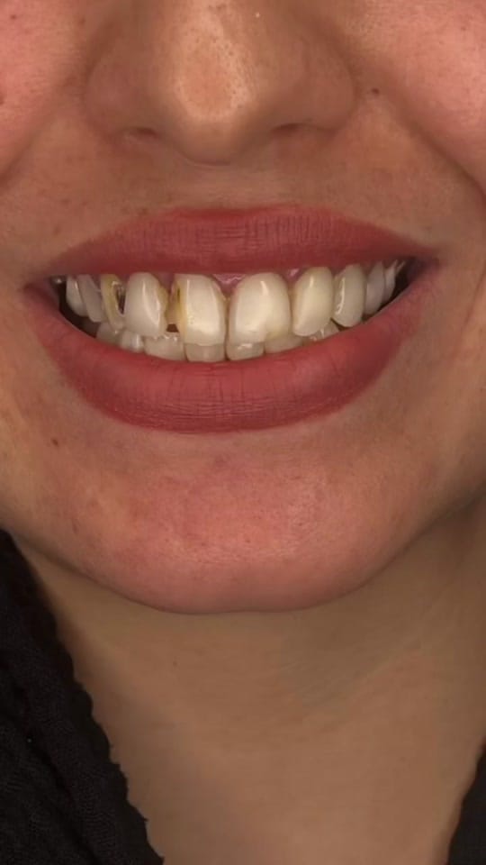 Post 4 by Brickell Dental on TikTok (video)