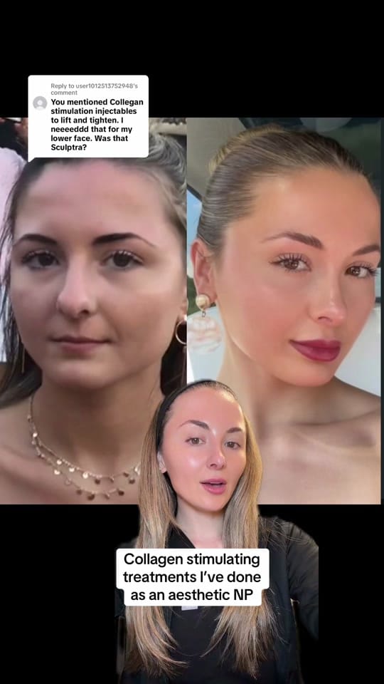 Post 3 by Courtney | Austin Injector on TikTok (video)