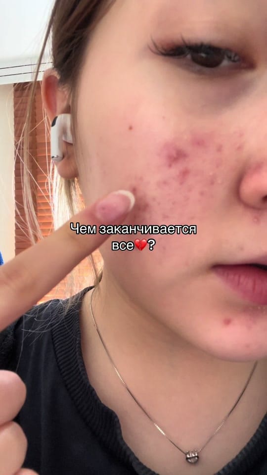 Post 10 by ailana🏹🤍 on TikTok (video)