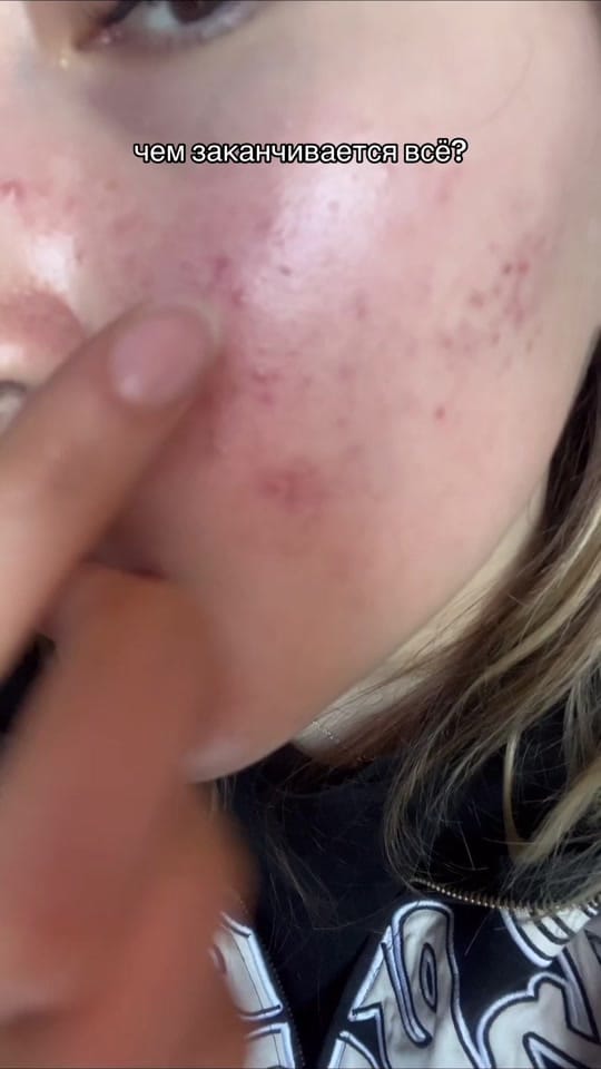 Post 2 by ailana🏹🤍 on TikTok (video)