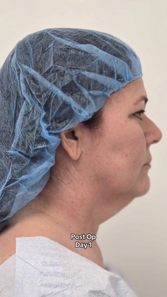 Post 1 by 1010 Plastic Surgery on TikTok (video)