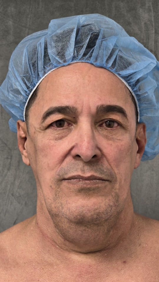 Post 4 by 1010 Plastic Surgery on TikTok (video)