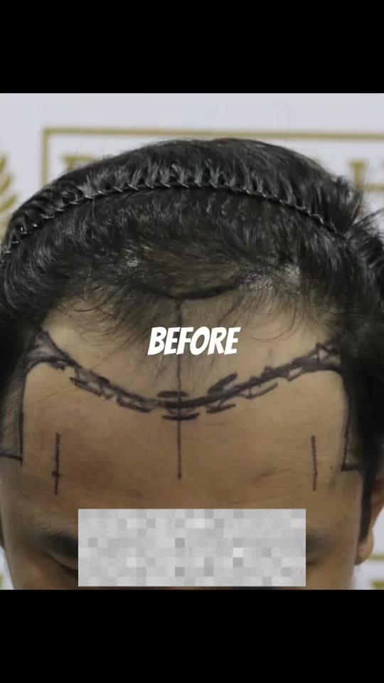 Post 5 by Dr Deena | Hair Doctor on TikTok (video)