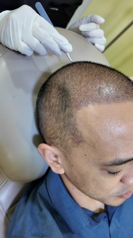 Post 3 by Dr Deena | Hair Doctor on TikTok (video)