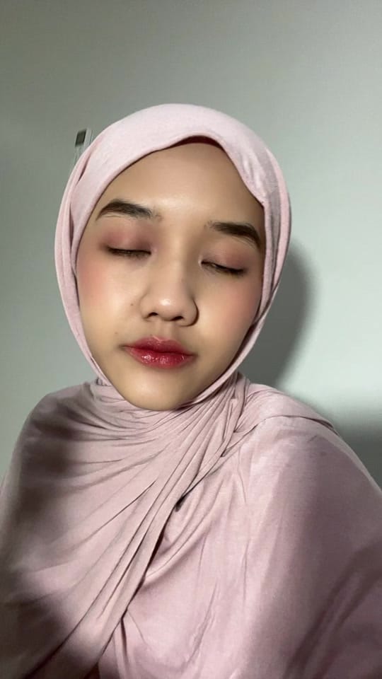 Post 1 by Ega Vanessa | Dry skin on TikTok (video)