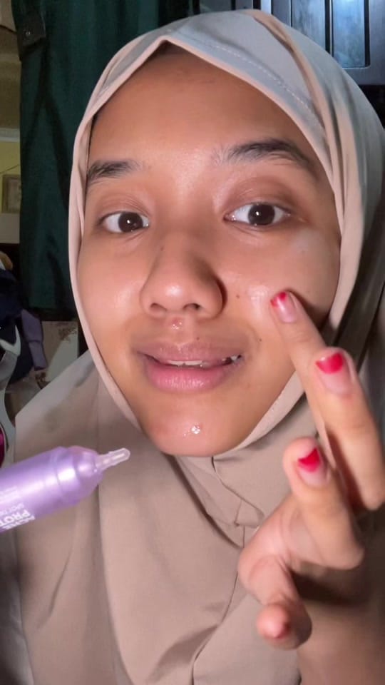 Post 9 by Ega Vanessa | Dry skin on TikTok (video)