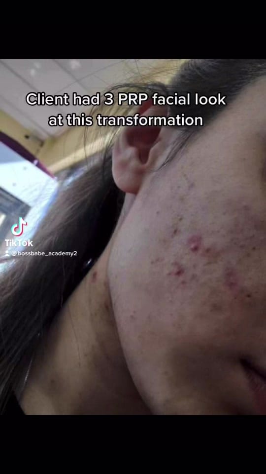 Post 3 by bossbabe_medspa on TikTok (video)