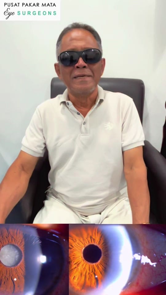 Post 2 by EyeSurgeons Taman Equine on TikTok (video)