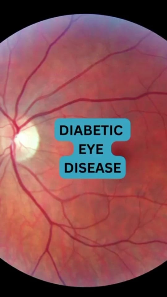 Post 8 by EyeSurgeons Taman Equine on TikTok (video)