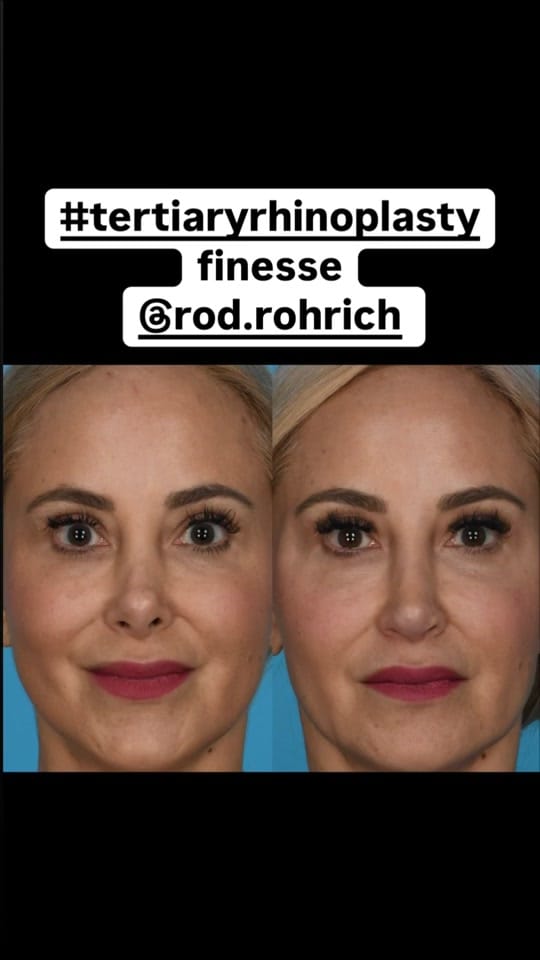 Post 9 by Dr. Rod Rohrich on TikTok (video)