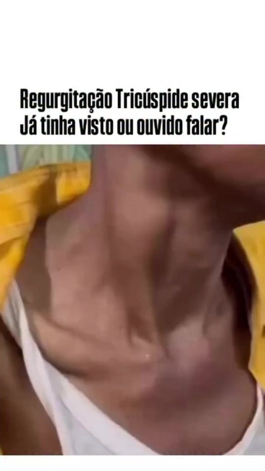 Post 8 by drrogeriosilvacardio on TikTok (video)