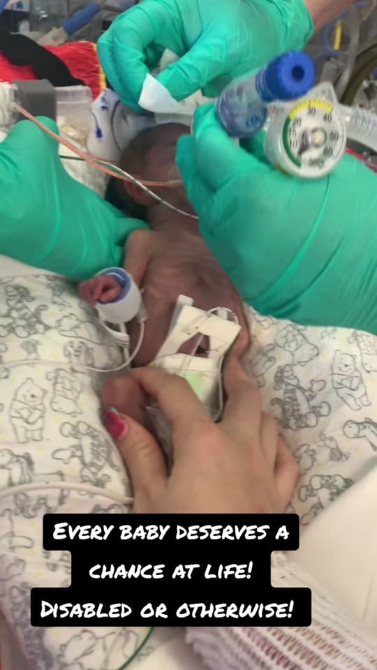 Post 2 by Challis on TikTok (video)