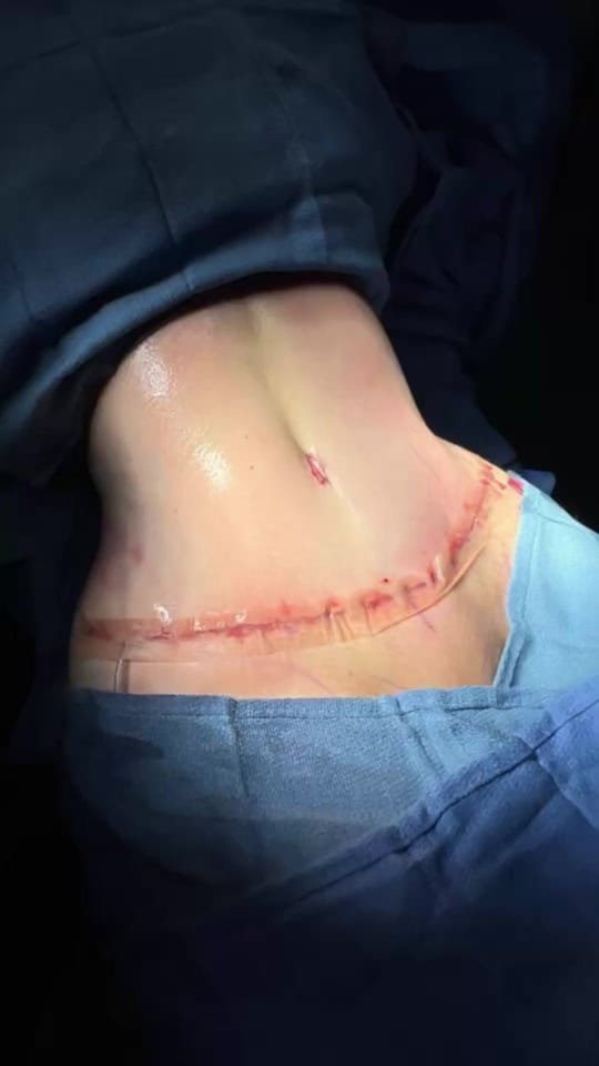 Post 4 by Curvy Plastic Surgery on TikTok (video)