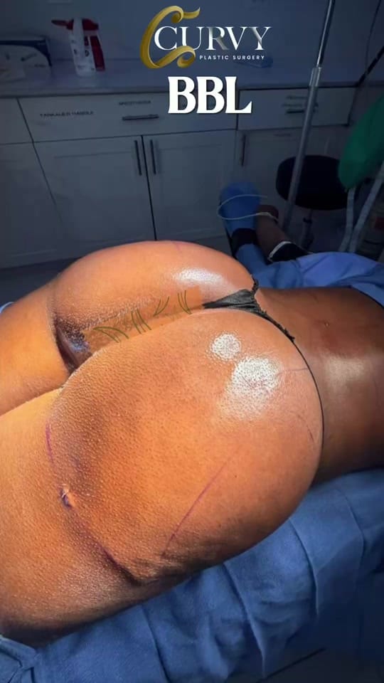 Post 6 by Curvy Plastic Surgery on TikTok (video)