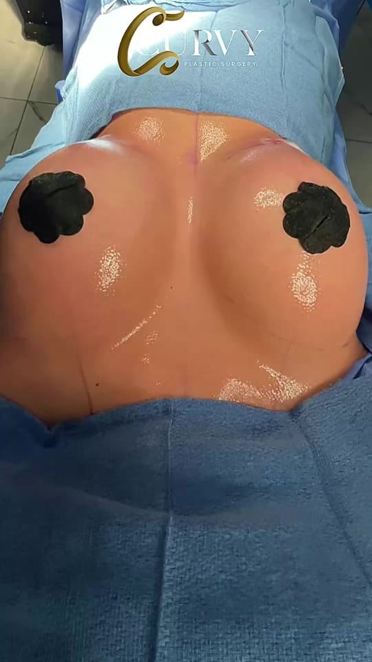 Post 8 by Curvy Plastic Surgery on TikTok (video)