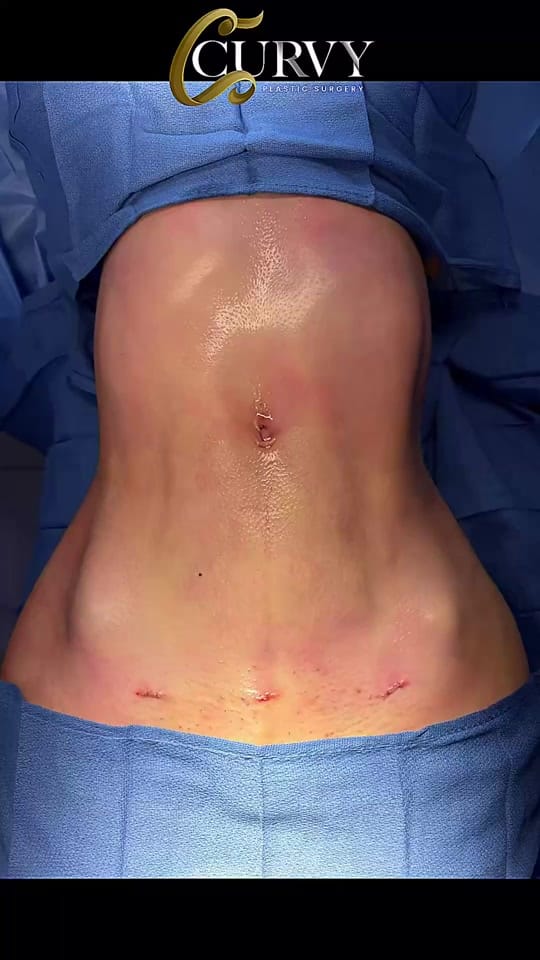 Post 3 by Curvy Plastic Surgery on TikTok (video)