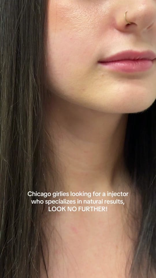 Post 4 by LAYLA | CHICAGO INJECTOR on TikTok (video)