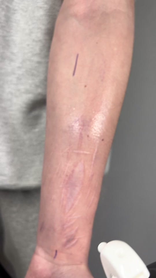 Post 9 by yoen_tattoo on TikTok (video)
