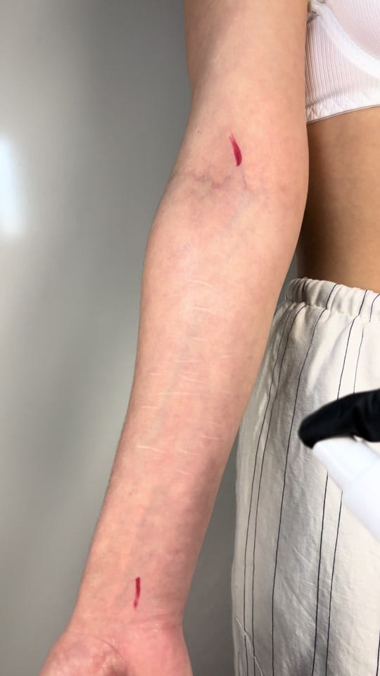 Post 8 by yoen_tattoo on TikTok (video)