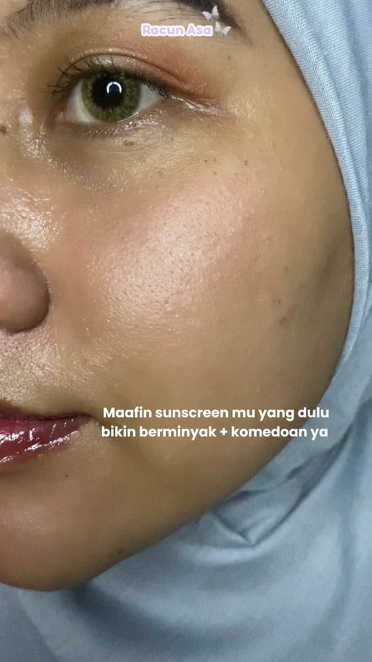Post 9 by Racun ASA on TikTok (video)