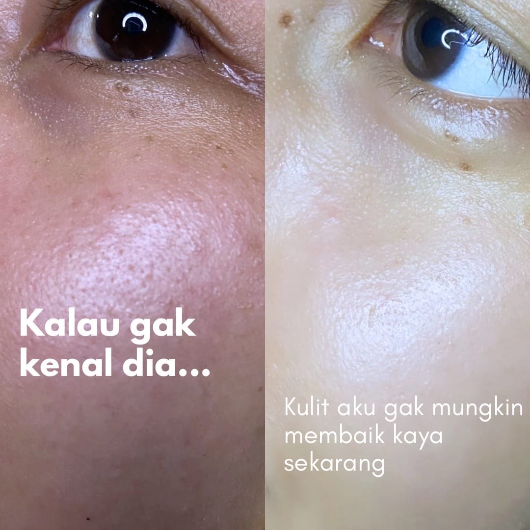 Post 10 by Racun ASA on TikTok (video)