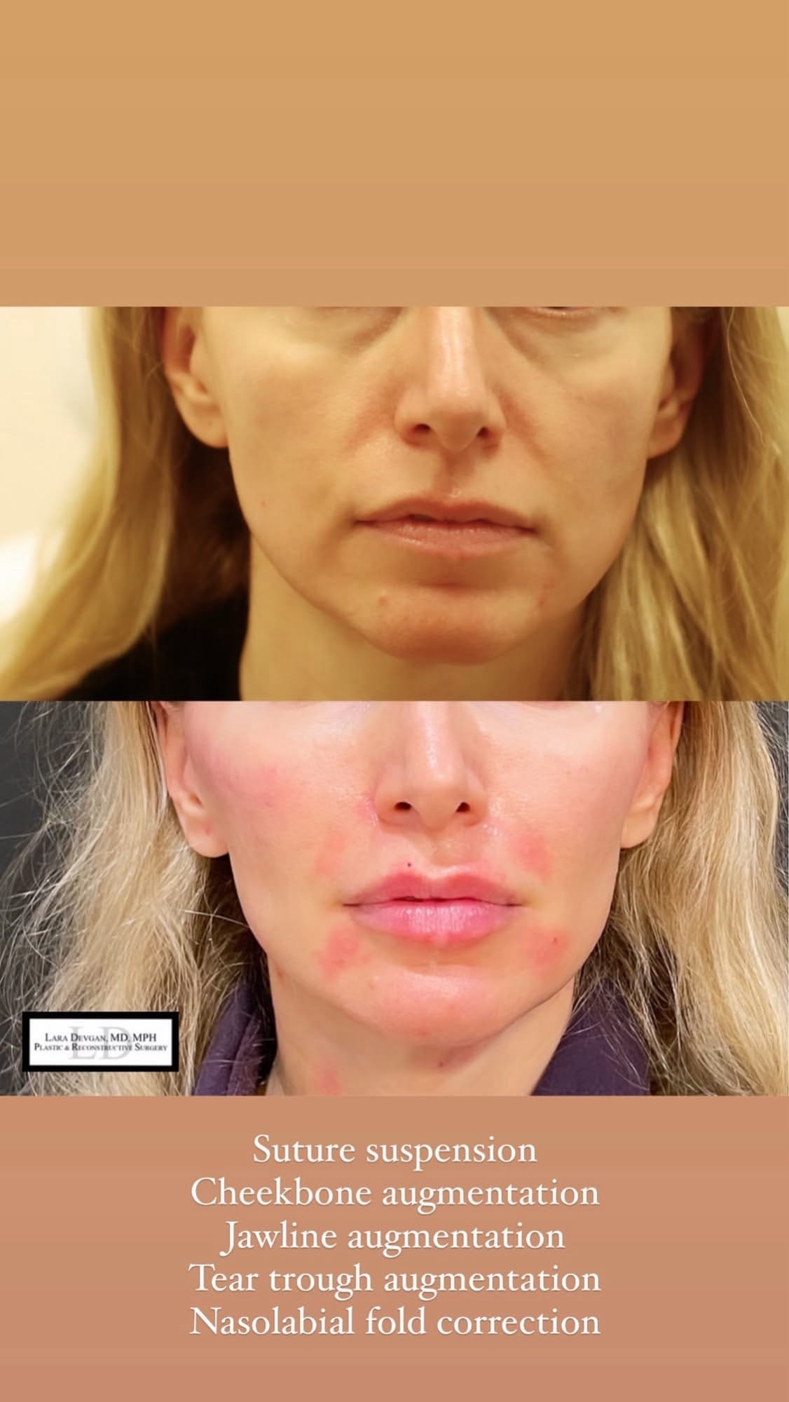 Post 3 by Dr. Lara Devgan on TikTok (video)