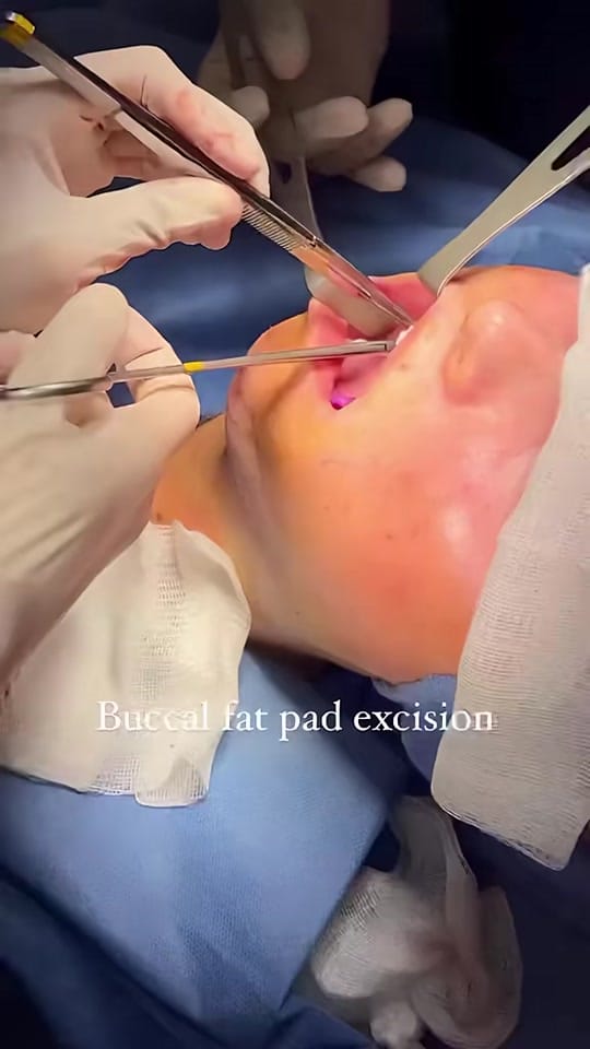 Post 5 by Dr. Lara Devgan on TikTok (video)