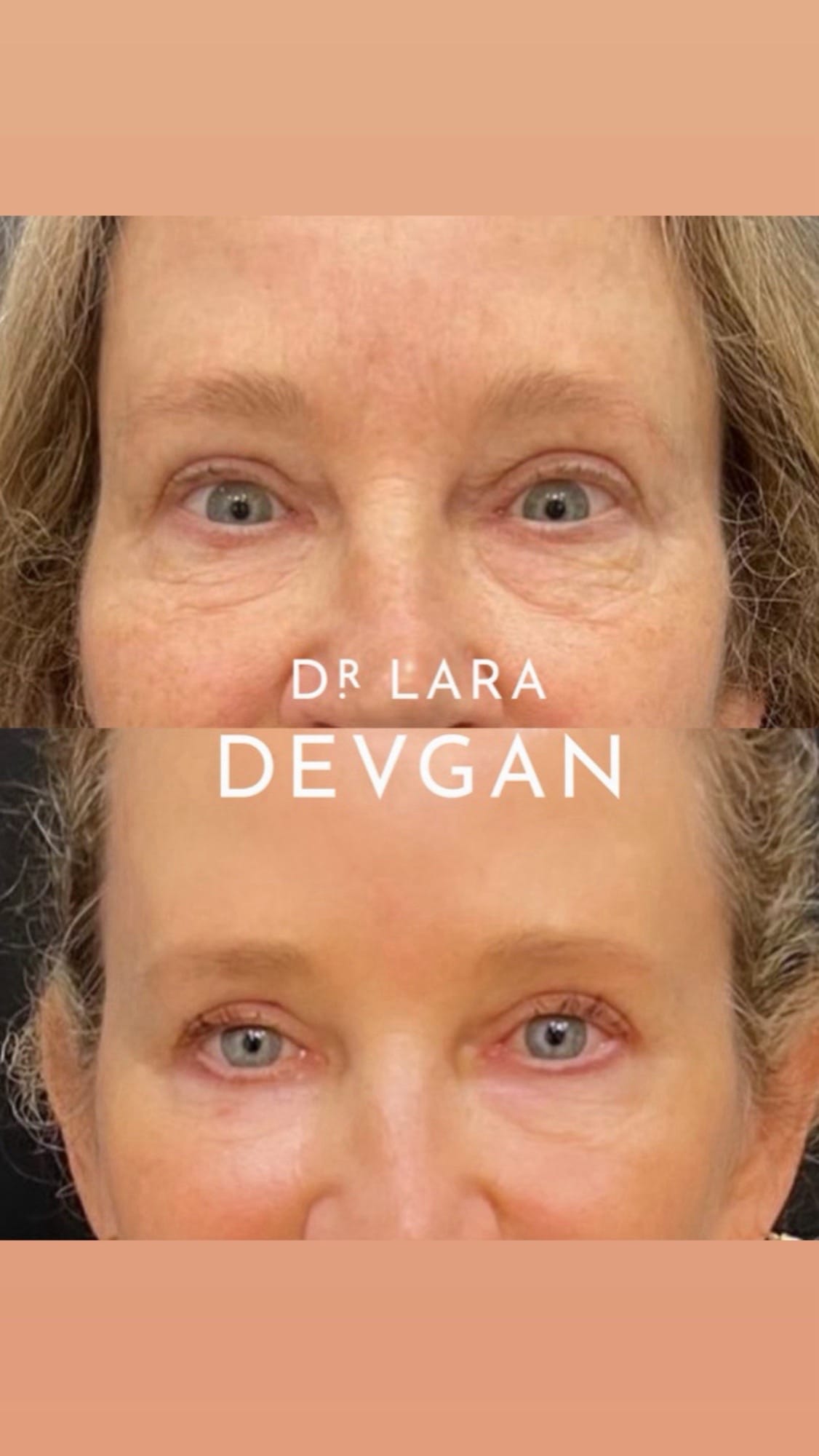 Post 9 by Dr. Lara Devgan on TikTok (video)