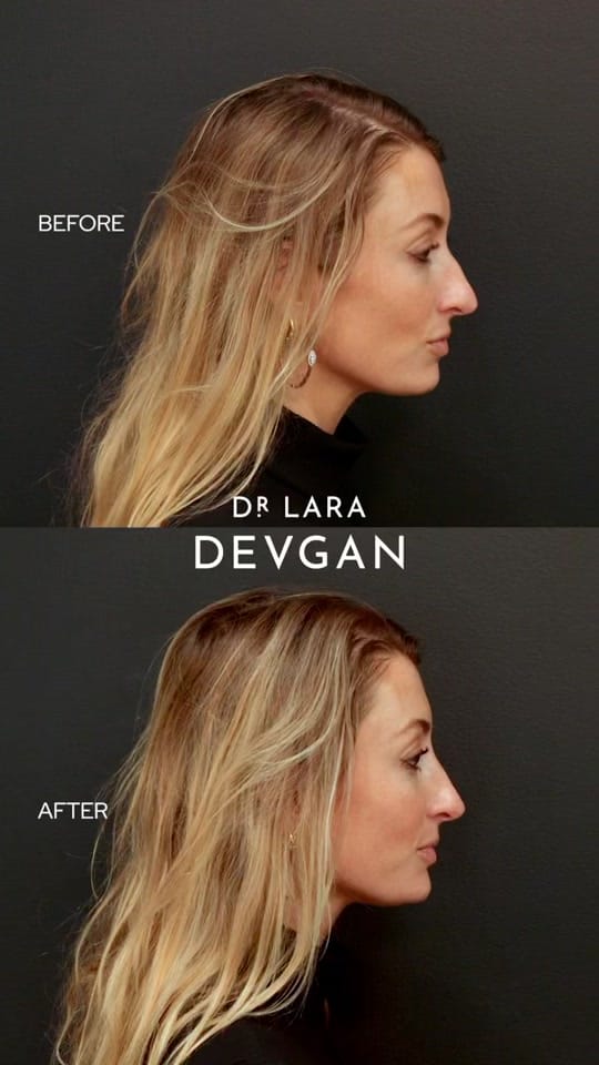 Post 7 by Dr. Lara Devgan on TikTok (video)