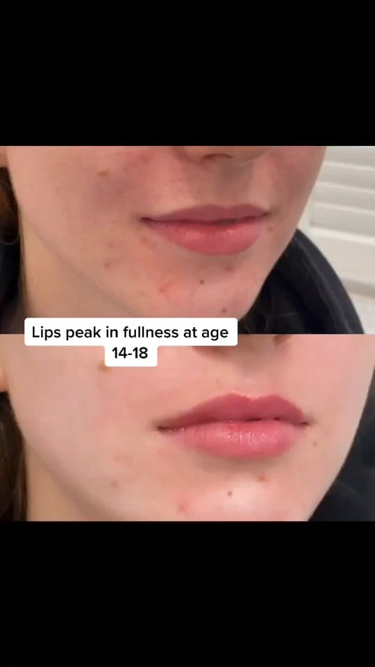 Post 10 by Dr. Lara Devgan on TikTok (video)