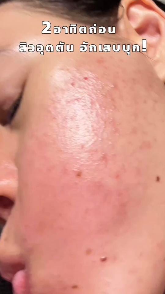 Post 4 by Medileen Official on TikTok (video)