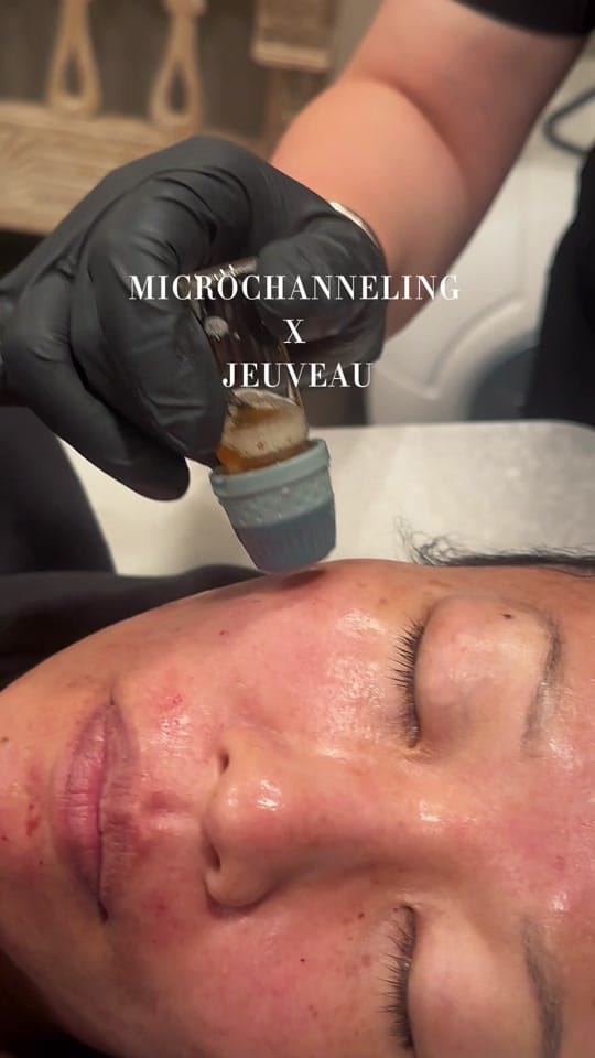 Post 2 by La Belle Vie MedSpa on TikTok (video)