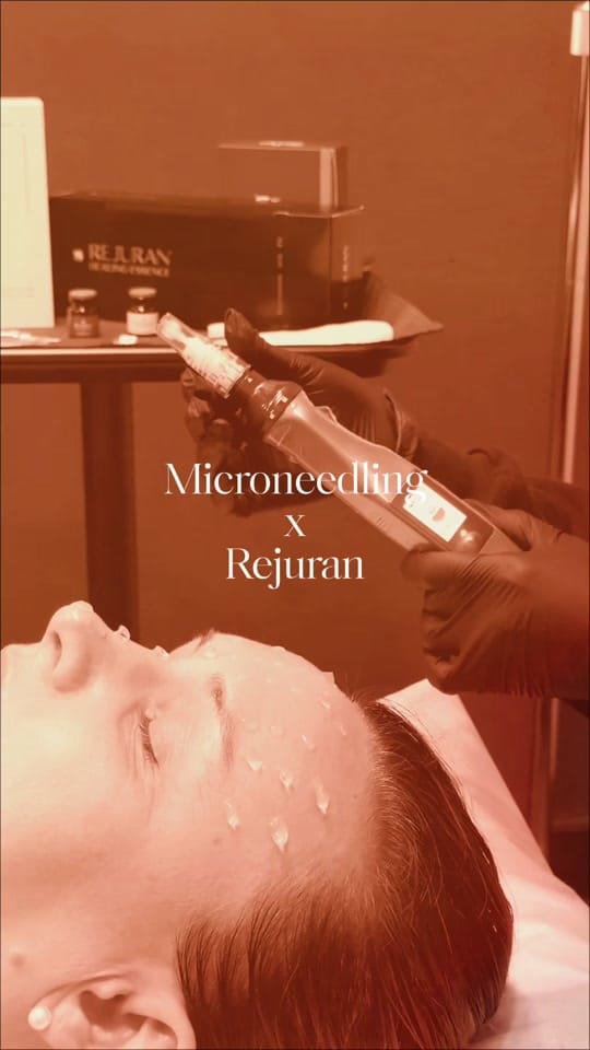 Post 8 by La Belle Vie MedSpa on TikTok (video)