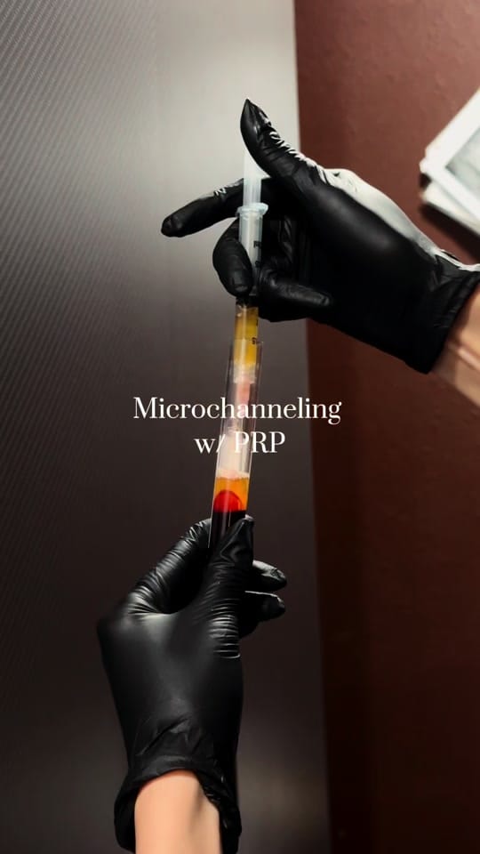 Post 7 by La Belle Vie MedSpa on TikTok (video)
