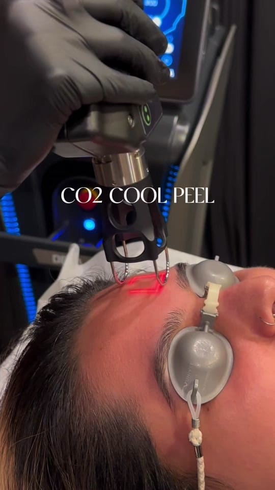 Post 4 by La Belle Vie MedSpa on TikTok (video)