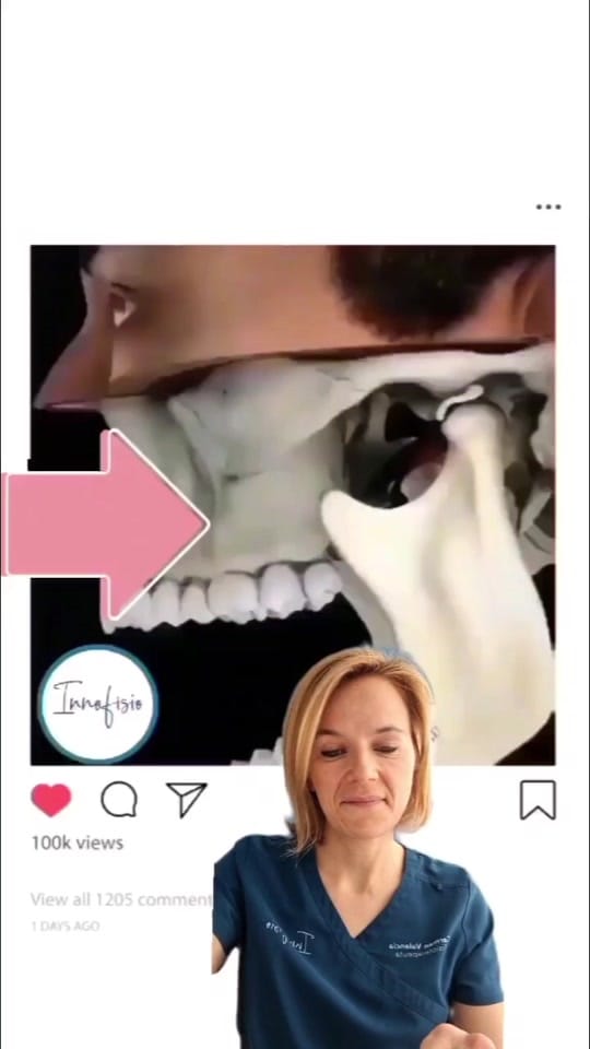 Post 10 by Fisioterapia_Innofisio on TikTok (video)