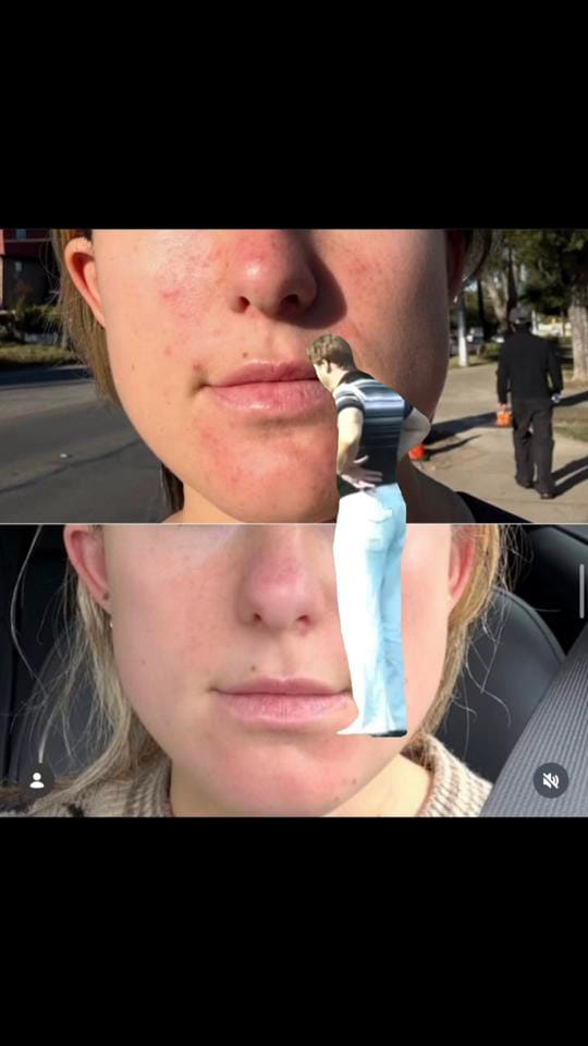 Post 2 by sknsciencerx on TikTok (video)