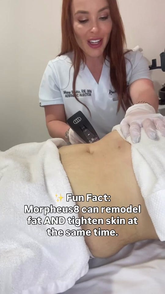 Post 9 by remakebeautymedspa1 on TikTok (video)
