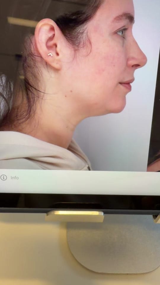Post 7 by MadnaniFacialPlastic on TikTok (video)