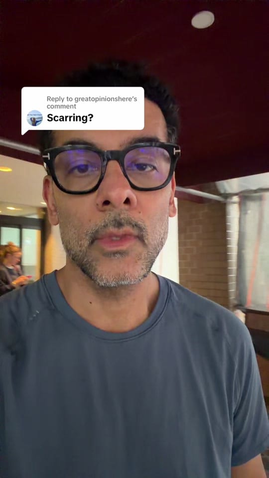 Post 8 by MadnaniFacialPlastic on TikTok (video)