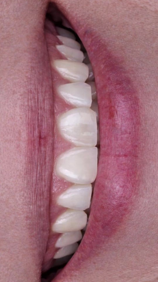 Post 10 by Venus Dentistry on TikTok (video)