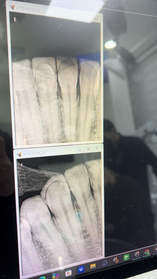 Post 7 by Venus Dentistry on TikTok (video)