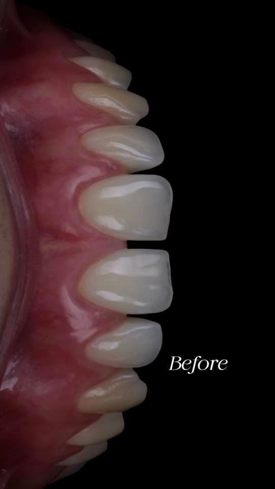 Post 3 by Venus Dentistry on TikTok (video)