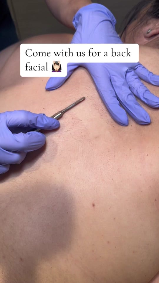 Post 9 by Jazzi Cosmetic Surgery on TikTok (video)