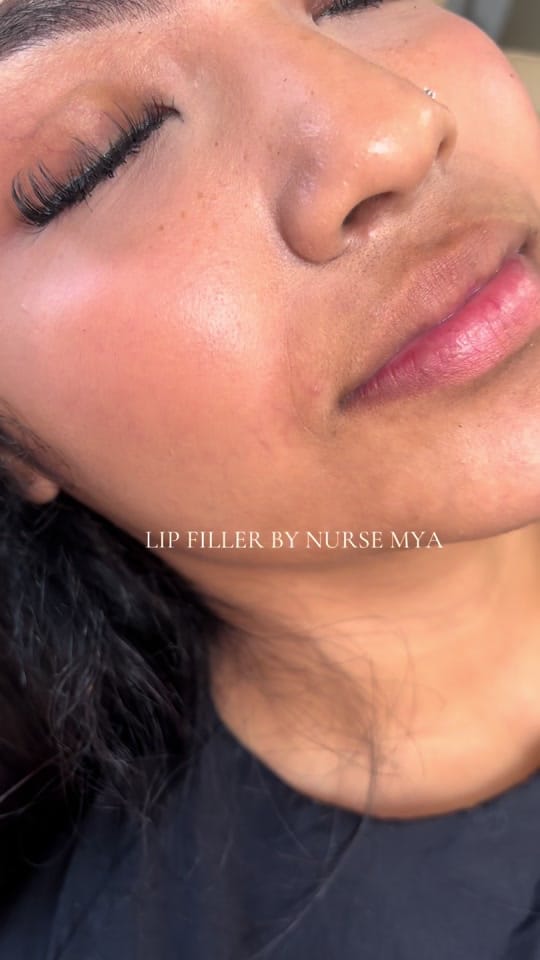 Post 7 by nurse_myaisabel on TikTok (video)