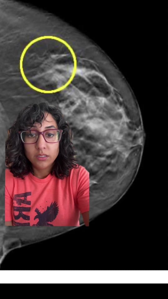 Post 2 by Dr. Amani Jambhekar on TikTok (video)